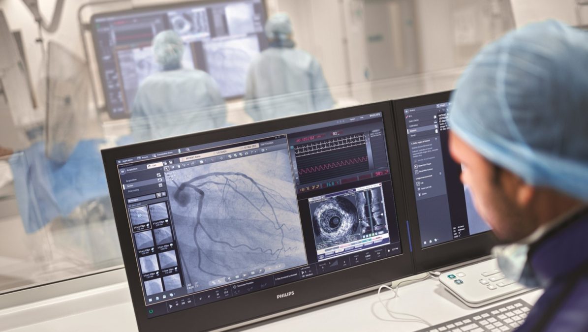 What does UX mean for patient care at Philips Healthcare?